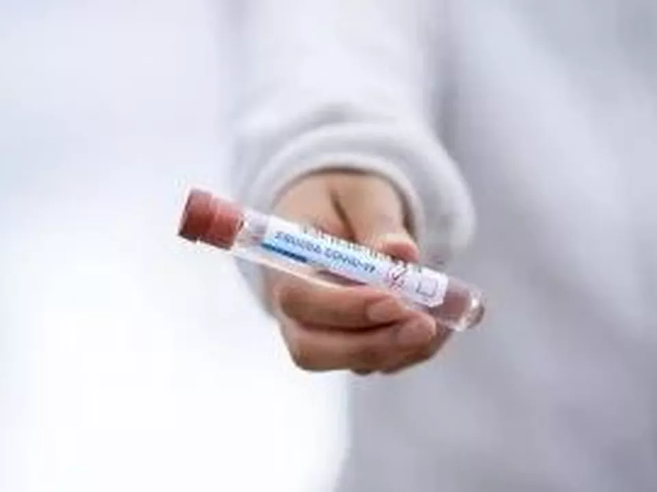 Ytterligare åtgärder med anledning av covid-19